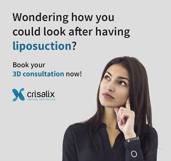 Crisalix 3D Simulation for Liposuction