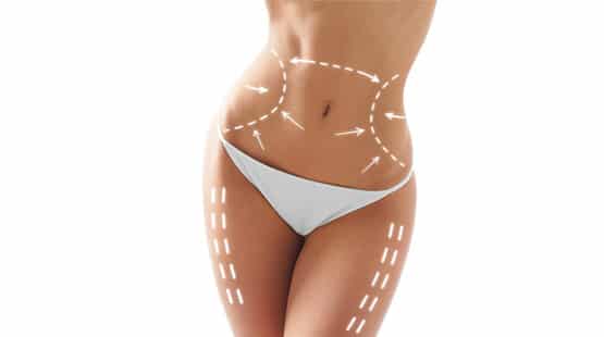 The Liposuction Advantage